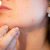 acne-1606765_960_720